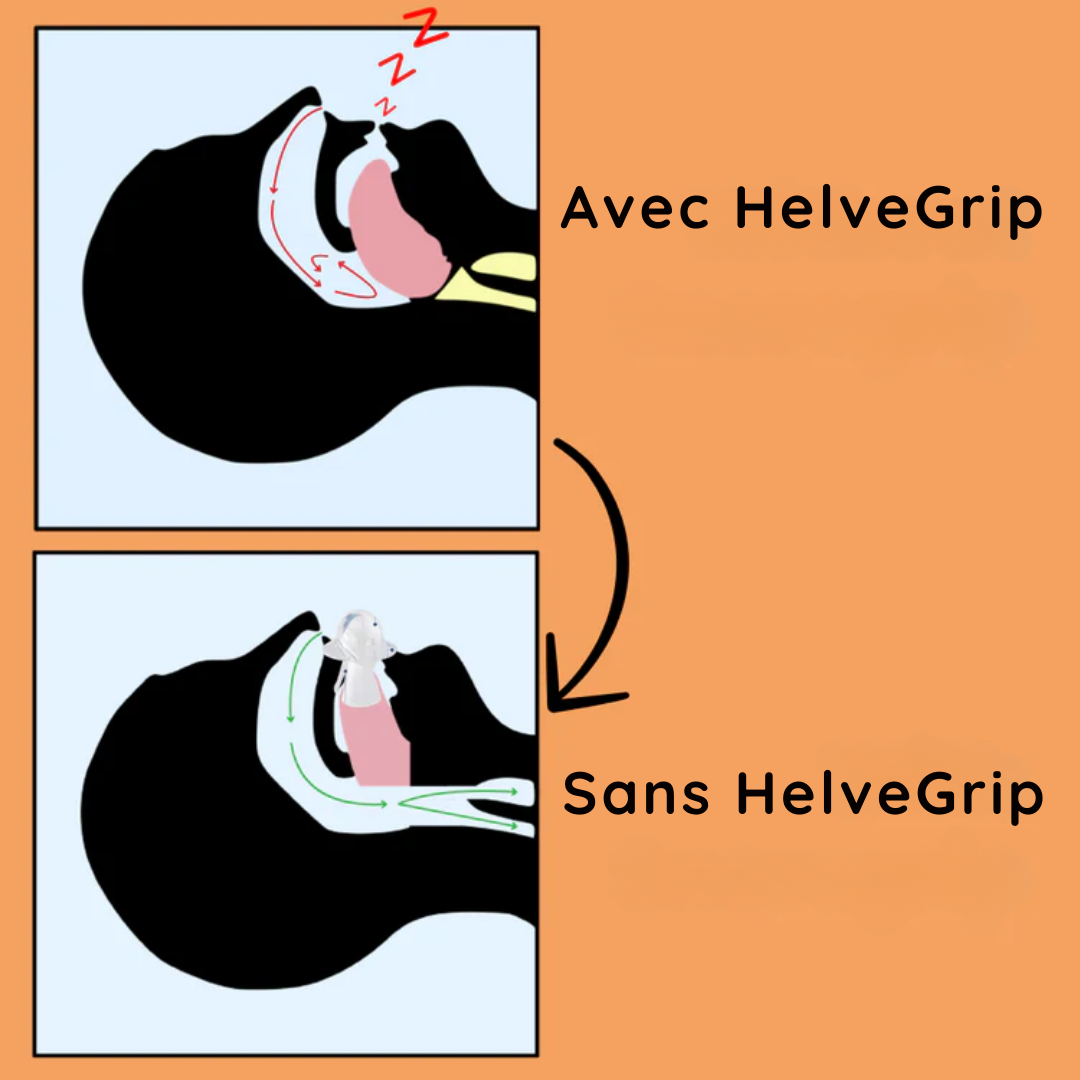 HelveGrip™
