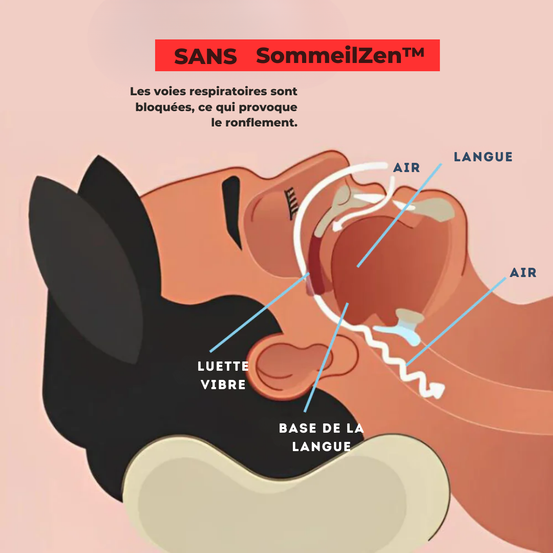 SleepZen™ von Helvezen | Die Anti-Schnarch-Lösung