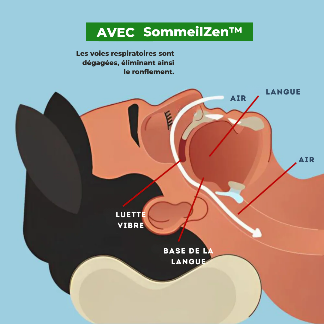 SleepZen™ von Helvezen | Die Anti-Schnarch-Lösung